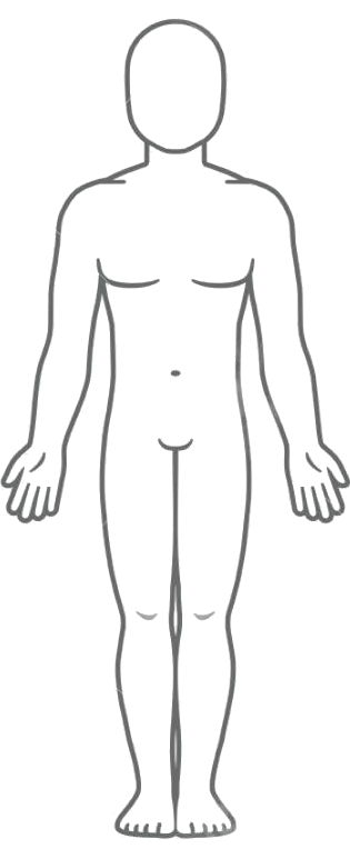 Body diagram with injury markers